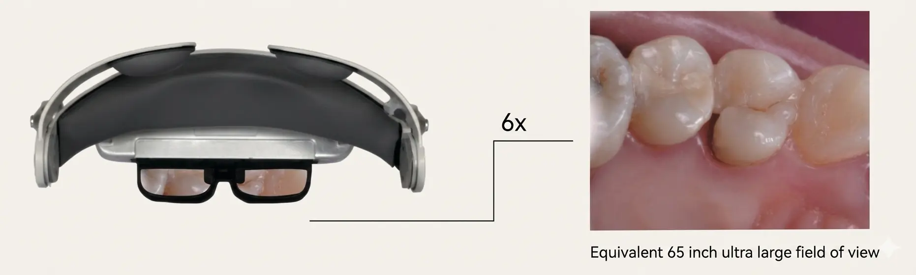 OLED display view